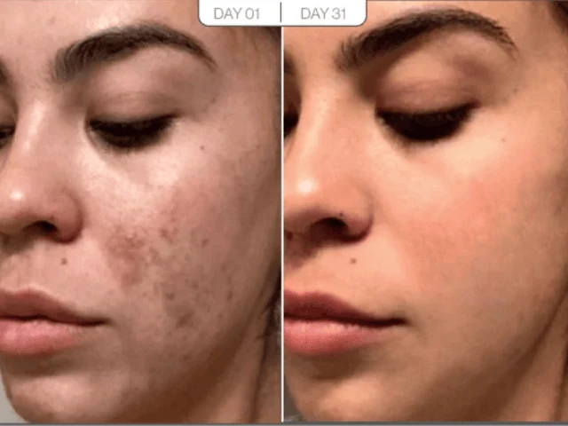 Skin Texture